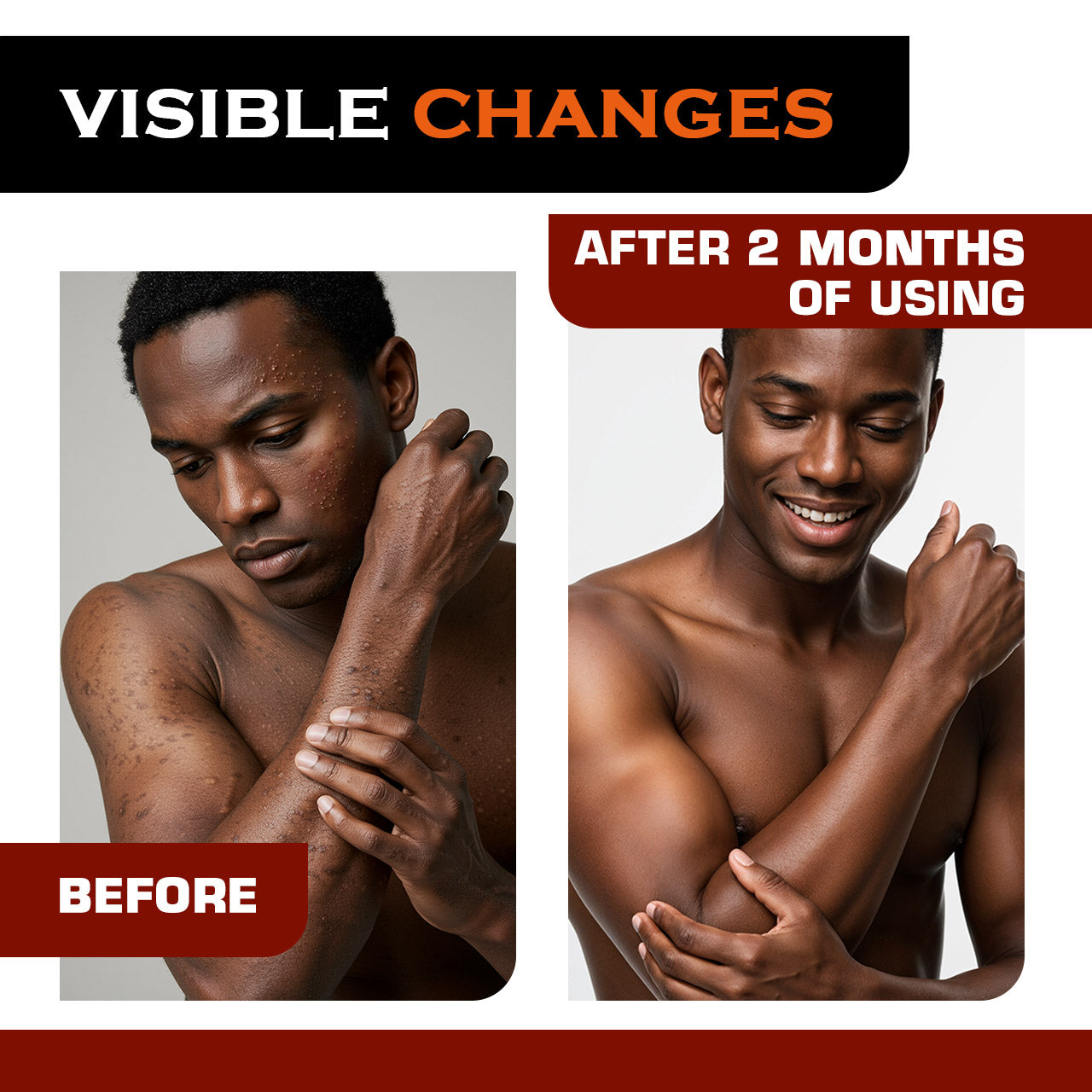 Before and after comparison of a man's arm with visible changes after using a product for two months.