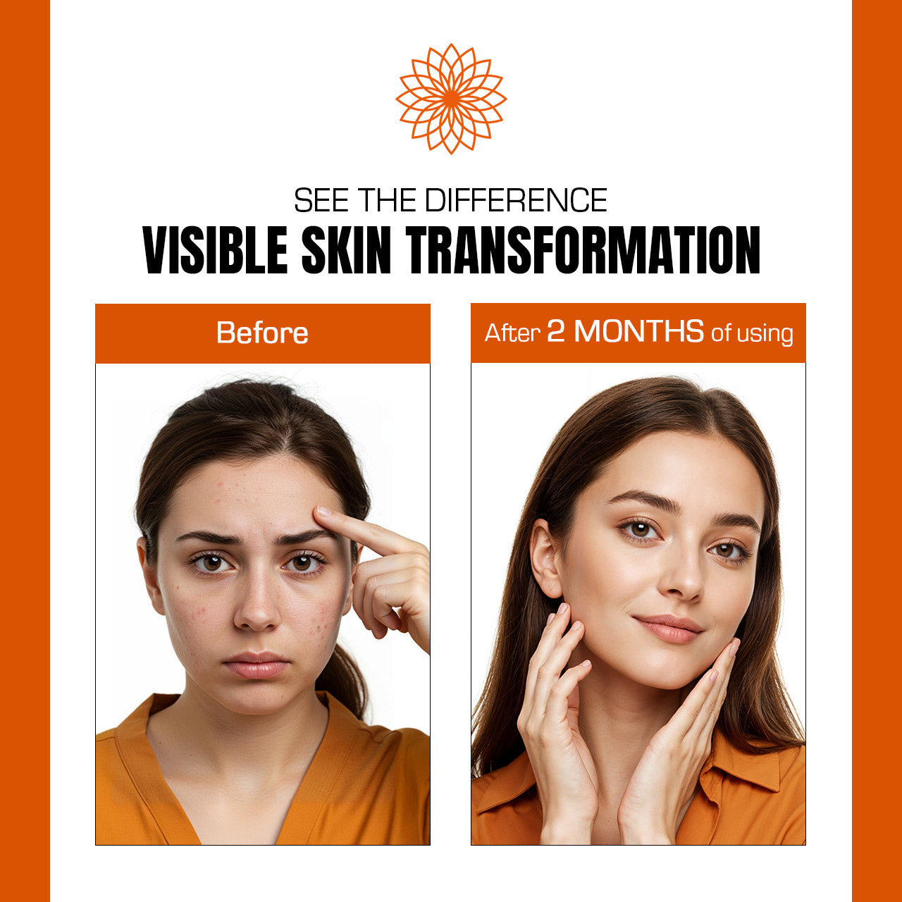 Before and after comparison of a woman's skin transformation with visible improvement after 2 months of using a product.