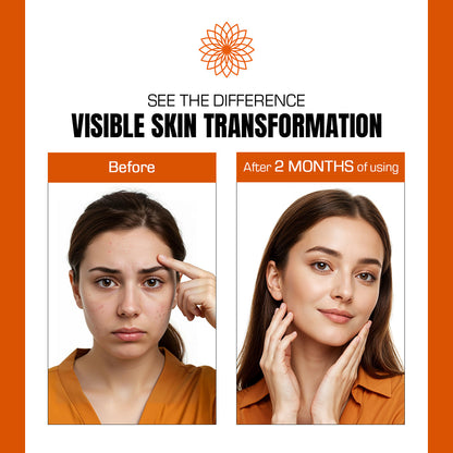 Before and after comparison of a woman's skin transformation with visible improvement after 2 months of using a product.