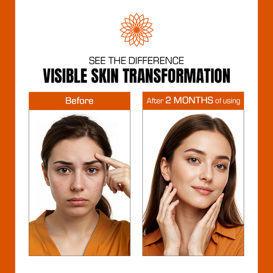 Before and after comparison of a woman's skin transformation with visible improvement after 2 months of using a product.